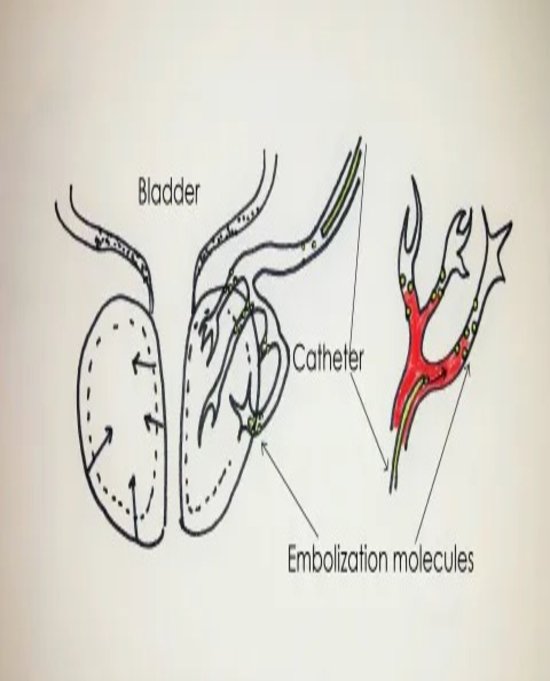 Interventional Radiology Equipment